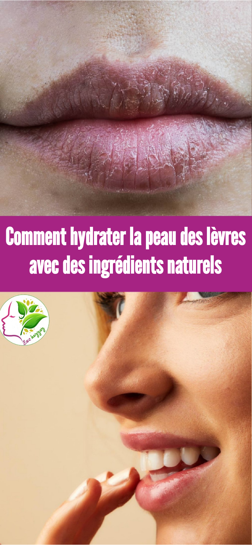 Comment hydrater la peau des lèvres avec des ingrédients naturels