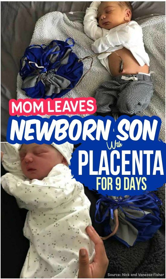 Baby Sleep Treatment Mom Leaves Newborn Son Attached To His Placenta