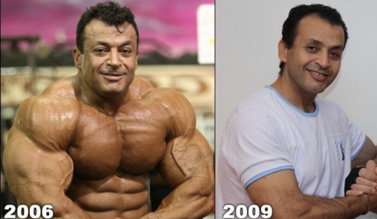 Best-Bodybuilders-Who-Faced-Complete-Muscle-Backing-Down