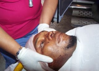 Oficial de la DNCD se debate entre la vida y la muerte al resivir un disparo en la cabeza