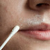 Get Rid of Unwanted Facial Hair at Home Naturally