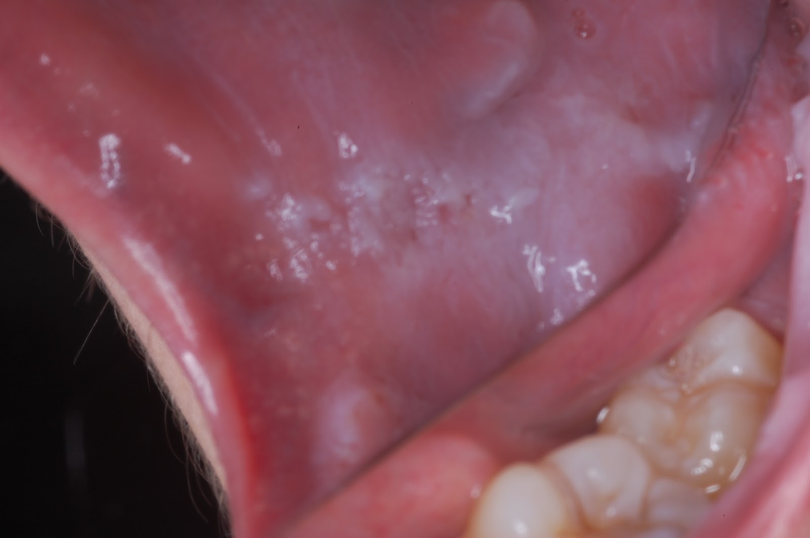 Spit Happens May 2012