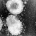 BAHIA / 1º caso confirmado coronavírus em sao domingos; na Bahia 91 casos