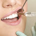 Tìm hiểu giá trồng răng sứ và quy trình thực hiện tại nha khoa
