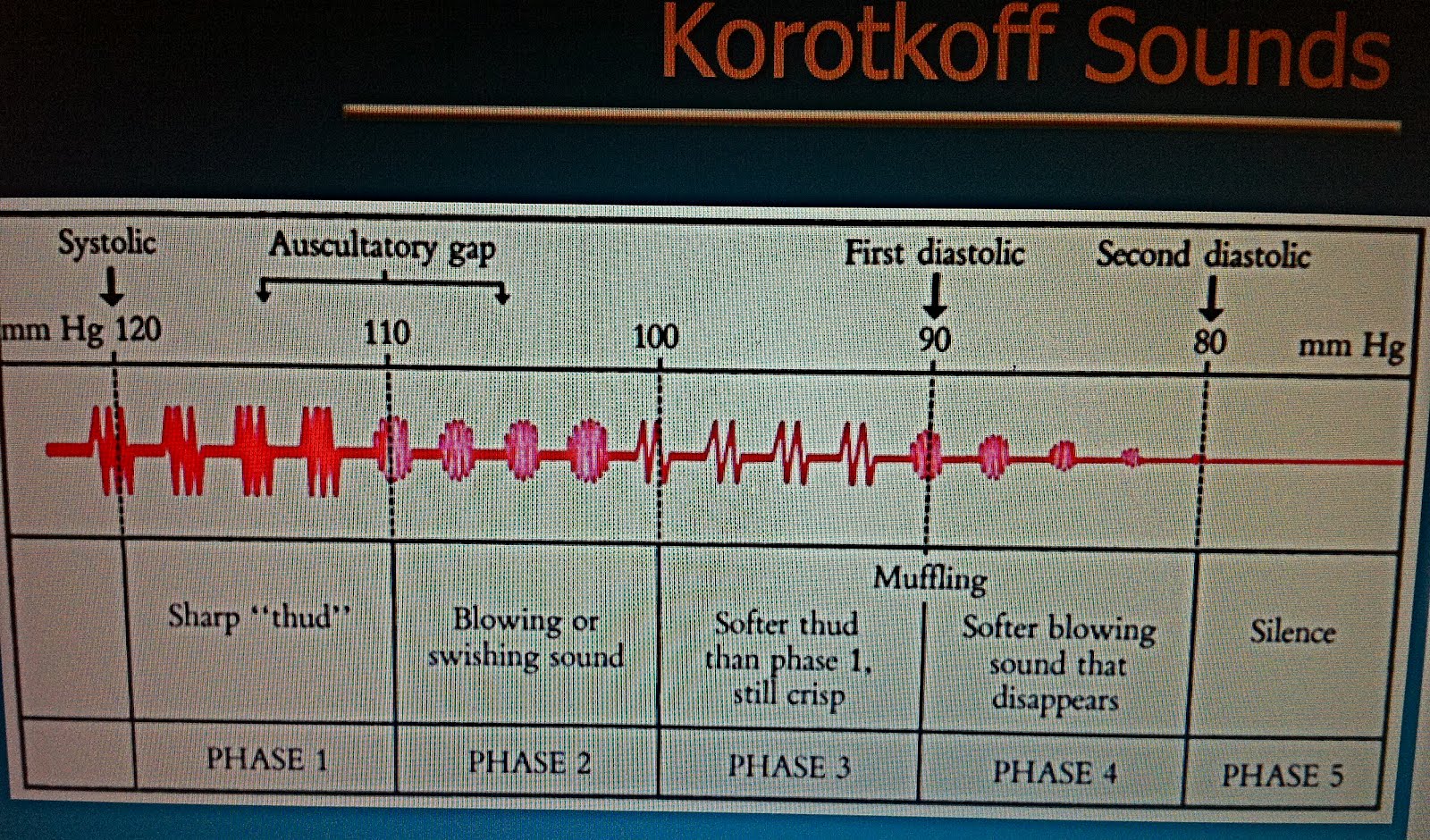 903 bipolar ways April 2012