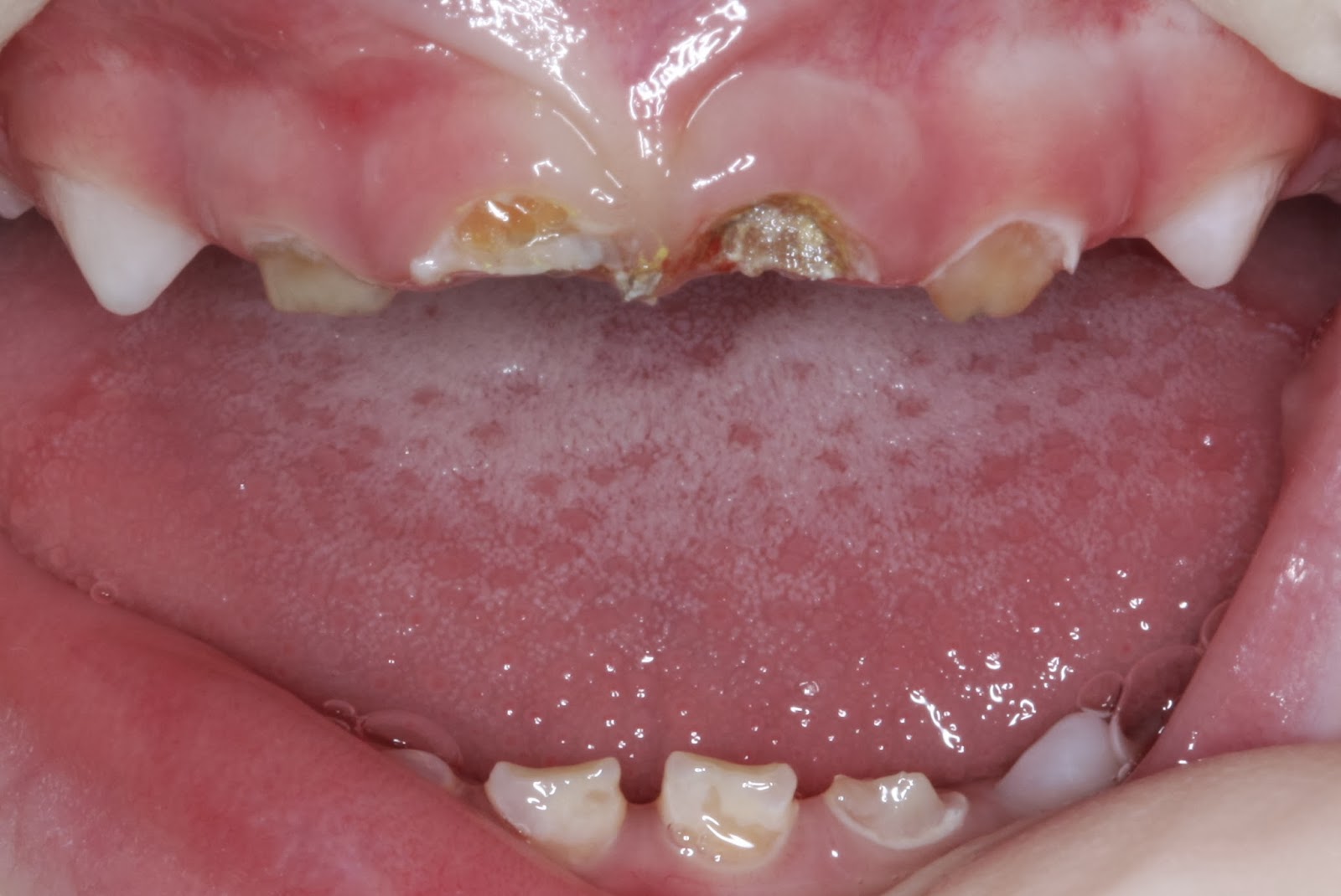 Детская стоматология и ортодонтия в Киеве - блог доктора Пешко Татьяны ...