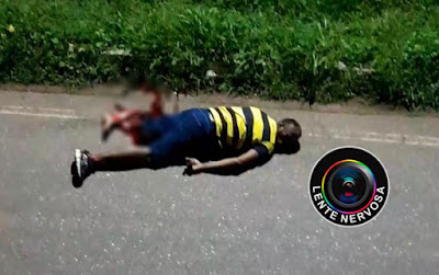 Motociclista tem a perna dilacerada ao cair da ponte sobre o Rio Madeira – IMAGENS FORTES