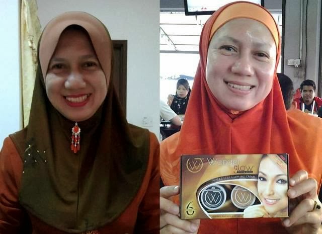 wonder glow skincare