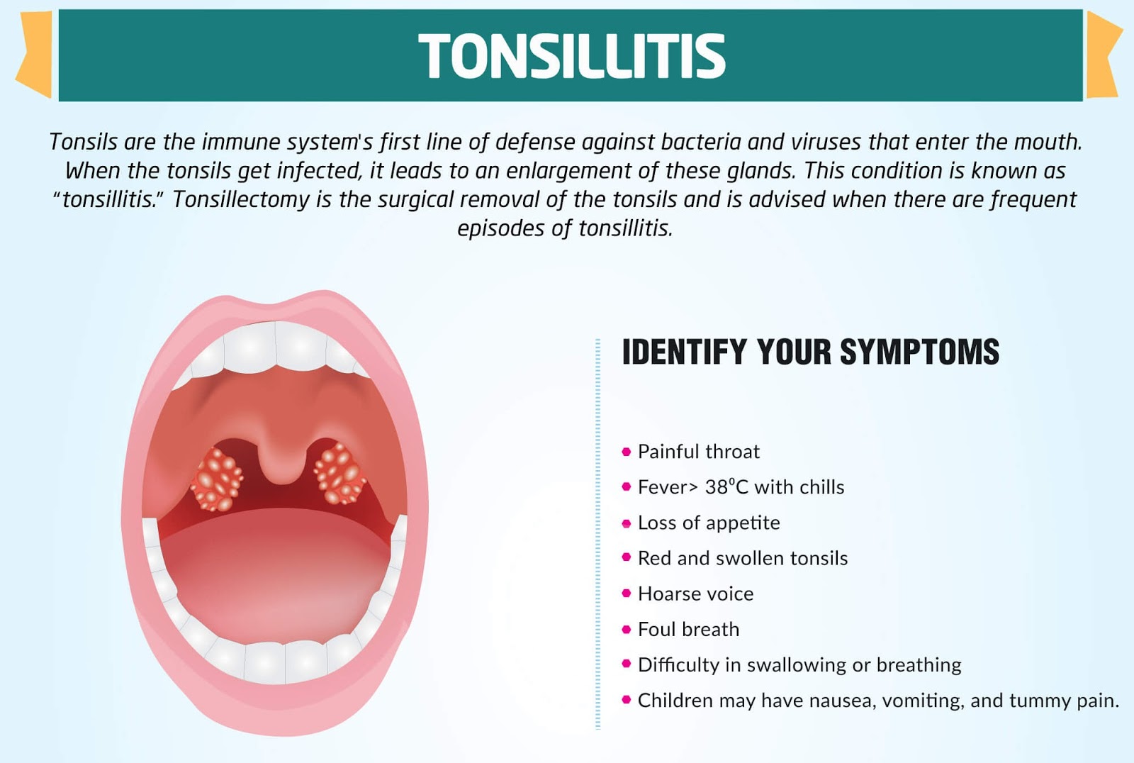 What Causes Swollen Tonsils With White Spots Adenoid Removal Tonsil ...