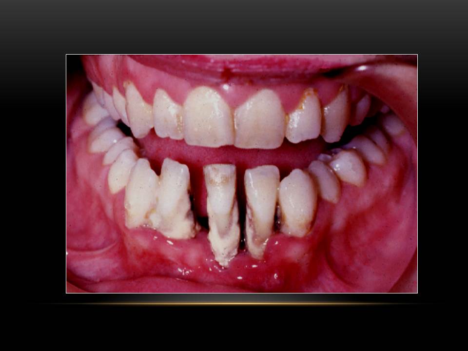 Dentistry Radiographic Image Selection Criteria