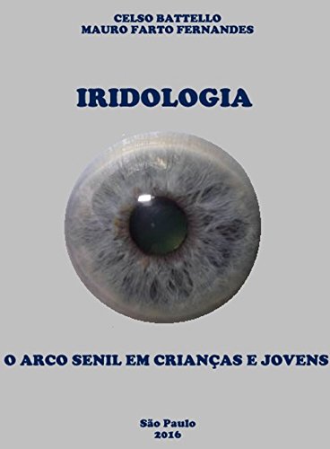 Iridologia - O Arco Senil em Crianças e Jovens - Mauro Farto Fernandes Iridologia - O Arco Senil em Crianças e Jovens - Mauro Farto Fernandes