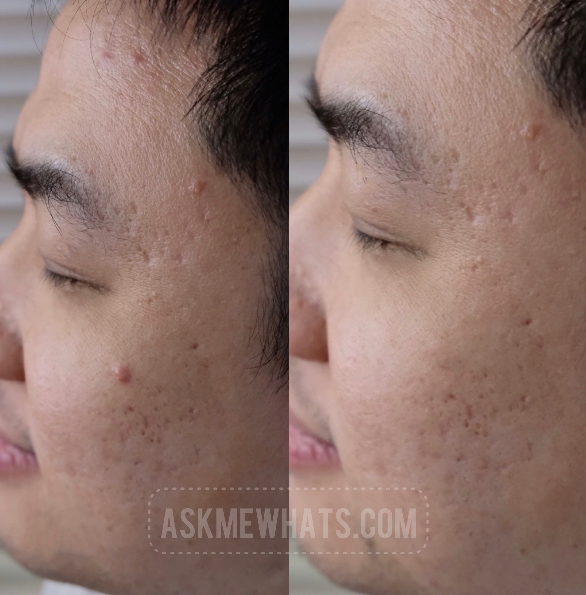 AskMeWhats Top Beauty Blogger Philippines Skincare Makeup Review