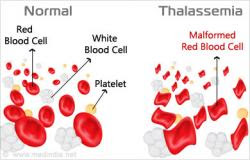 putuskan-mata-rantai-talassemia