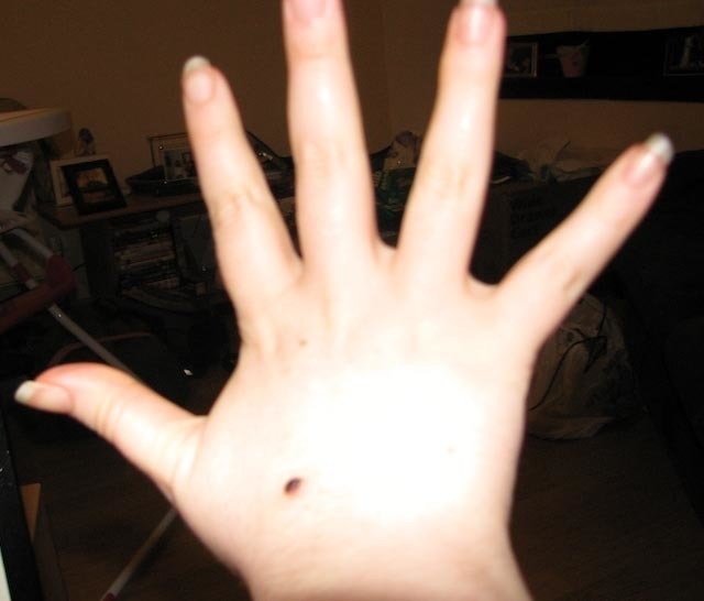 #24. You are also confident enough to share your knowledge with others. - These Moles On Your Body May Reveal Secrets About Your Life. #24. You are also confident enough to share your knowledge with others. - These Moles On Your Body May Reveal Secrets About Your Life.