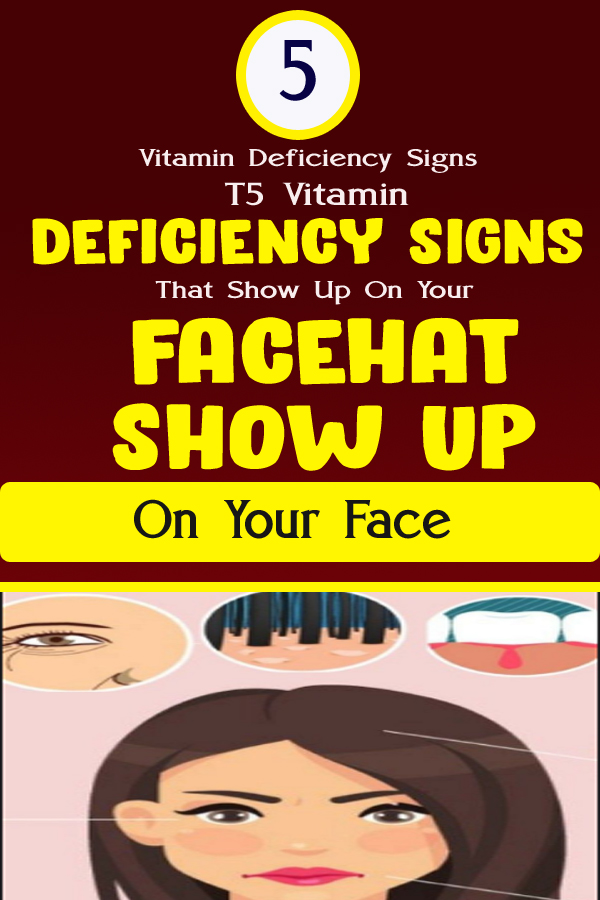 5 Vitamin Deficiency Signs That Show Up On Your Face