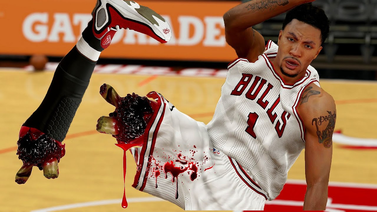 Bad Injuries In Basketball Basketball Choices