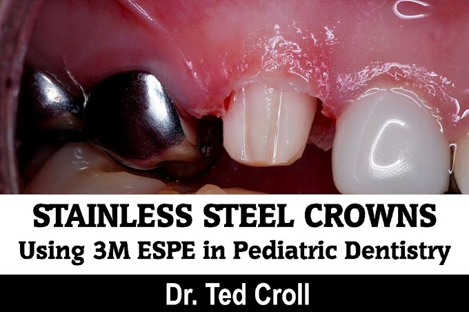 STAINLESS STEEL CROWNS: Using 3M ESPE in Pediatric Dentistry - Dr. Ted Croll