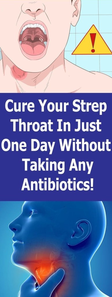 Can Valacyclovir Treat Strep Throat Cure Your Strep Throat In Just One Day Without Taking Any Antibiotics!!!
