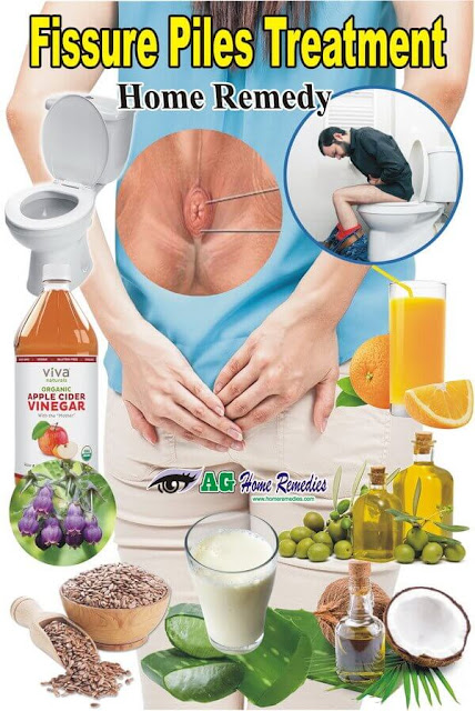 Fissure Piles Treatment Home Remedy Fissure Piles Treatment Home Remedy