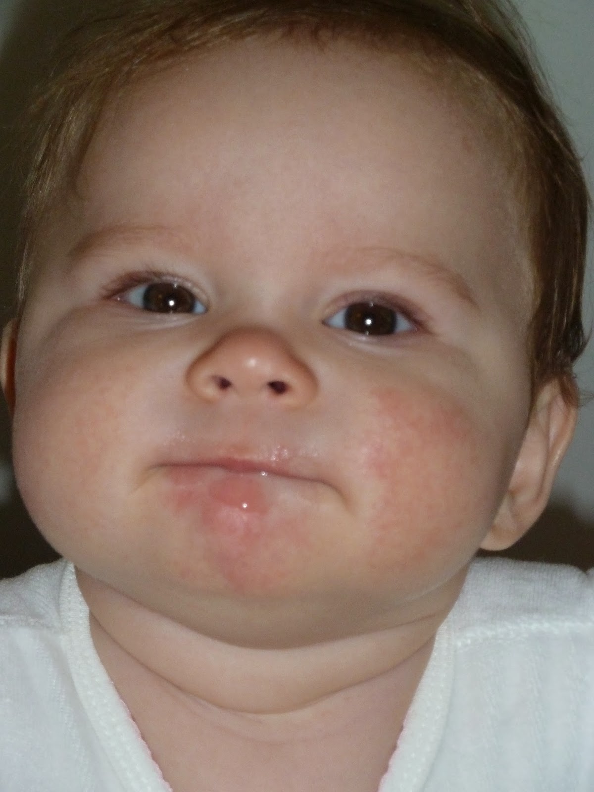healthy-gluten-free-diet-how-to-tell-if-your-baby-has-a-food-allergy