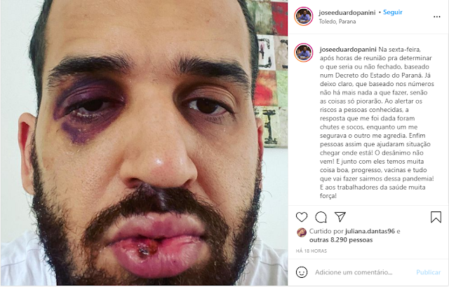 Médico é agredido por familiar após alertar sobre riscos da Covid-19, no Paraná: 'Dói, mas sinto que estou do lado que zela pela vida'