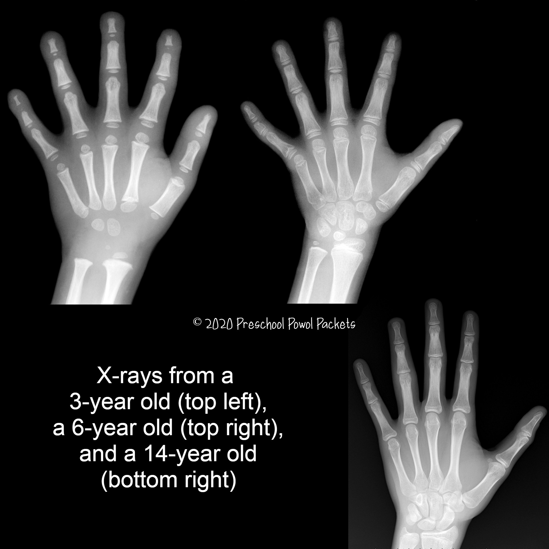 Printable X Rays Preschool