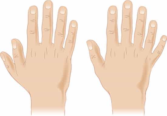Diseases - Why The 6 Fingers Per Hand Are Better Than 5