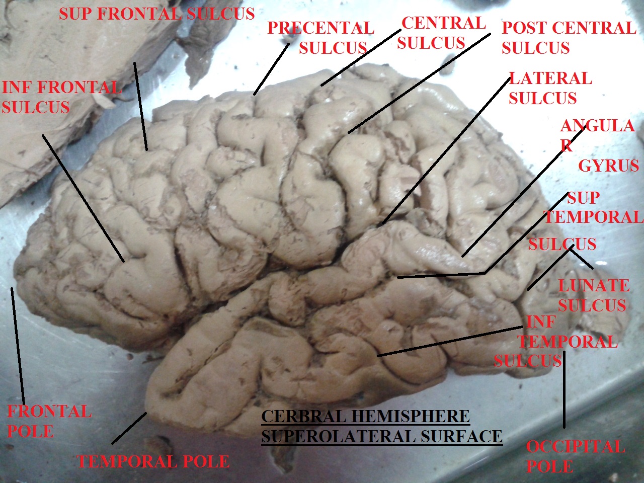Neuroanatomy Labelled Specimen for 2nd Yr MBBS Spotting