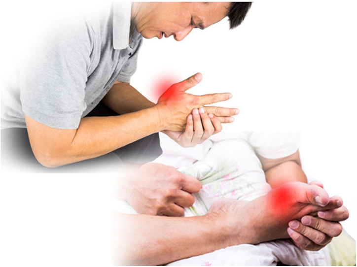 4 Dangerous Gout Myths That You Probably Believe 4 Dangerous Gout