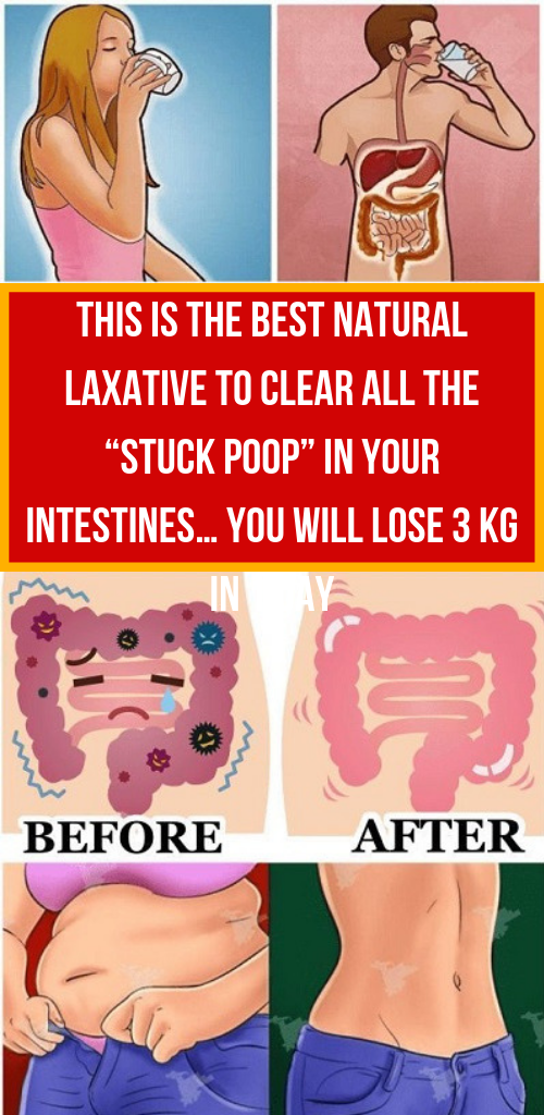 Let Start Slim Today This is the Best Natural Laxative to Clear all