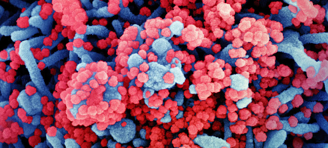 Micrografía electrónica de barrido coloreada de una célula (azul) muy infectada con partículas del virus SARS-CoV-2 (rojo).NIAID/NIH