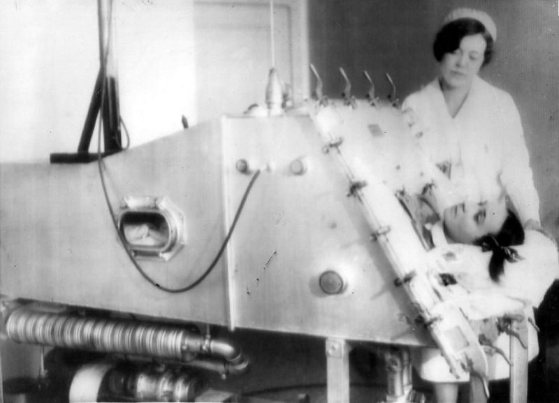 20 Vintage Photos of Iron Lungs for Polio Victims From Between the