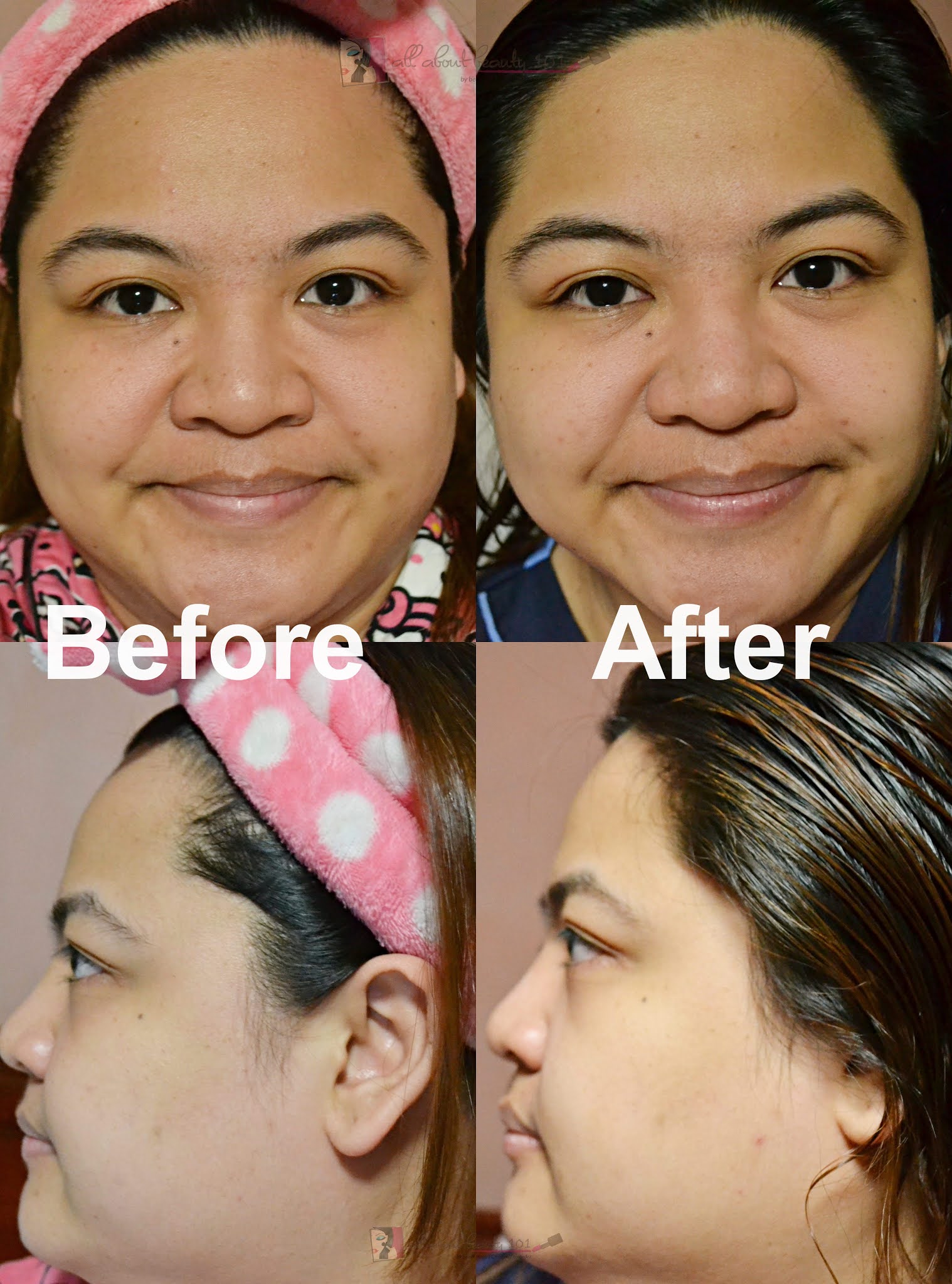 Foreo UFO Detailed Review And Comparison To UFO Mini All About