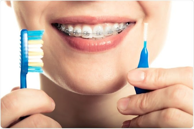 Teeth Care- 21 Tips to Take Care of Your Dental Health at home