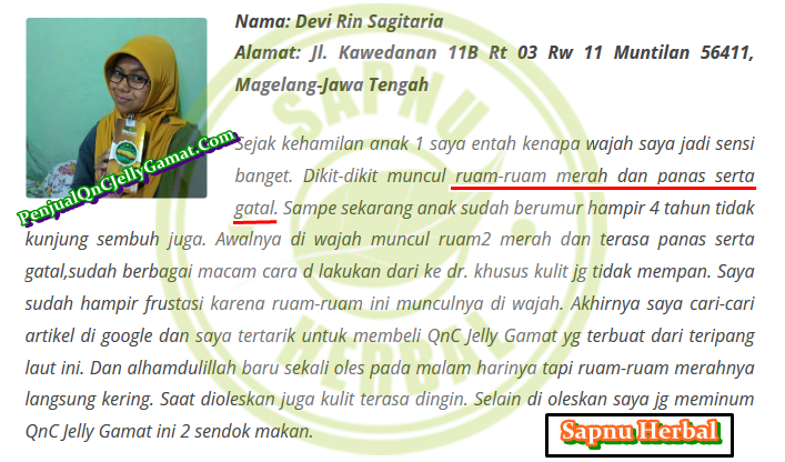 Cara Menghilangkan Bintik Merah Seperti Jerawat Di Kulit Perut Terbukti Mujarab ~ TESTIMONI QNC JELLY GAMAT Cara Menghilangkan Bintik Merah Seperti Jerawat Di Kulit Perut Terbukti Mujarab ~ TESTIMONI QNC JELLY GAMAT