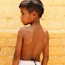 Eight-year-old 'hairy' Indian boy was born with an unusual patch of hair on his lower back