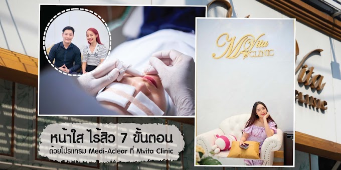 รีวิว : รักษาสิว หน้าใสใน 7 ขั้นตอน ด้วยโปรแกรม Medi-Aclear ที่ m vita clinic 