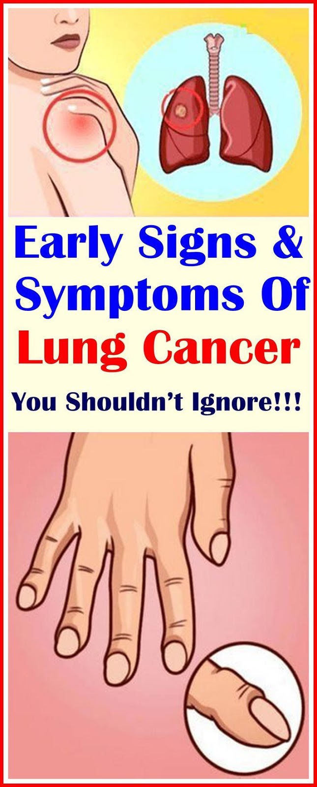 early signs of lung cancer