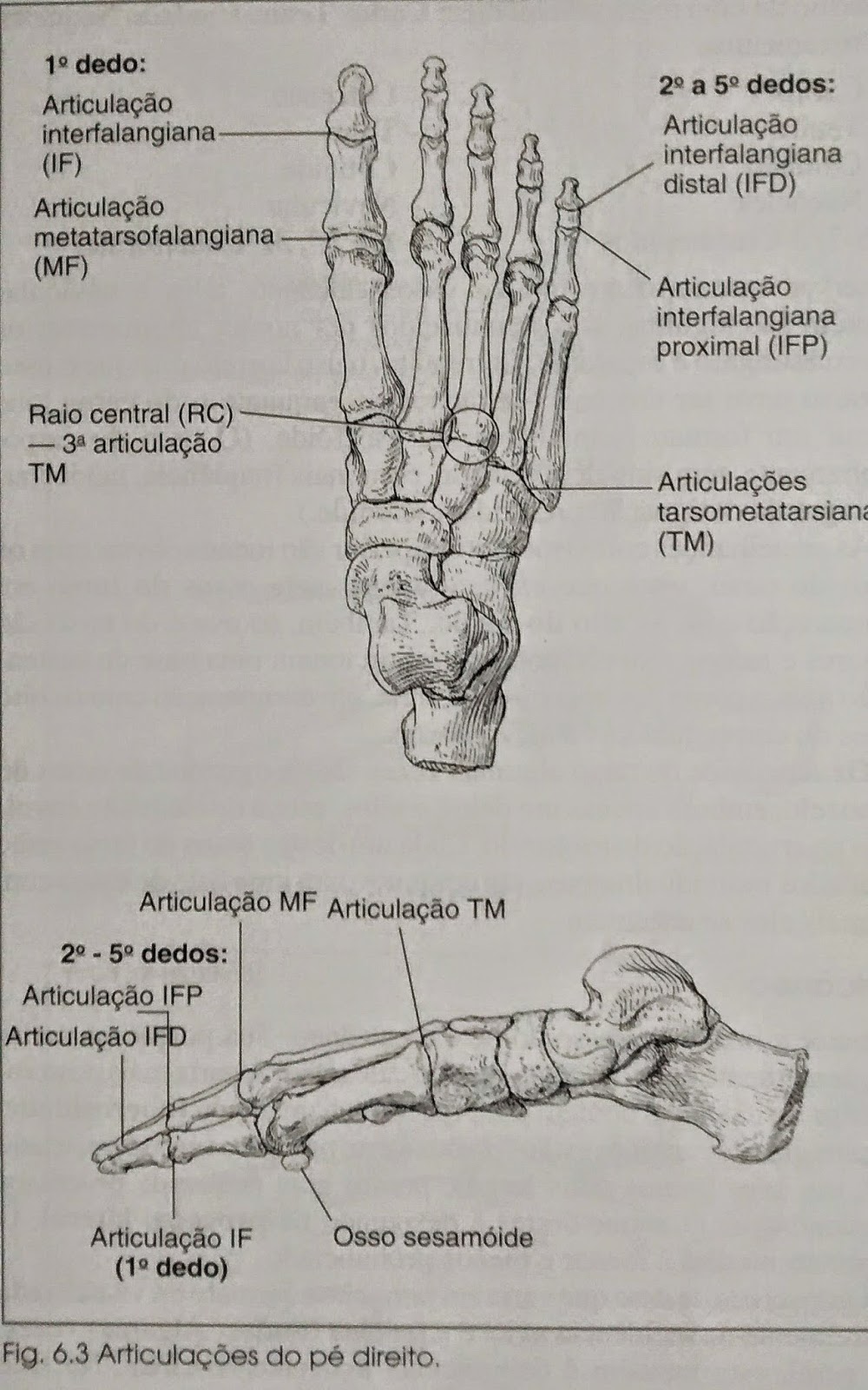 Artrita reumatoidă (AR)