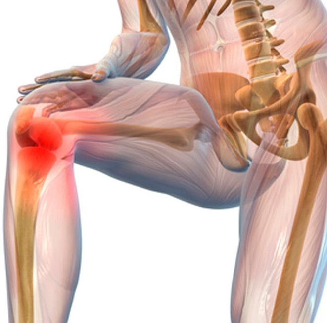 Как называются люди которые хрустят. Схема суставов человека. Хруст в суставах причины. Как называются люди которые хрустят. Как называются люди которые хрустят.