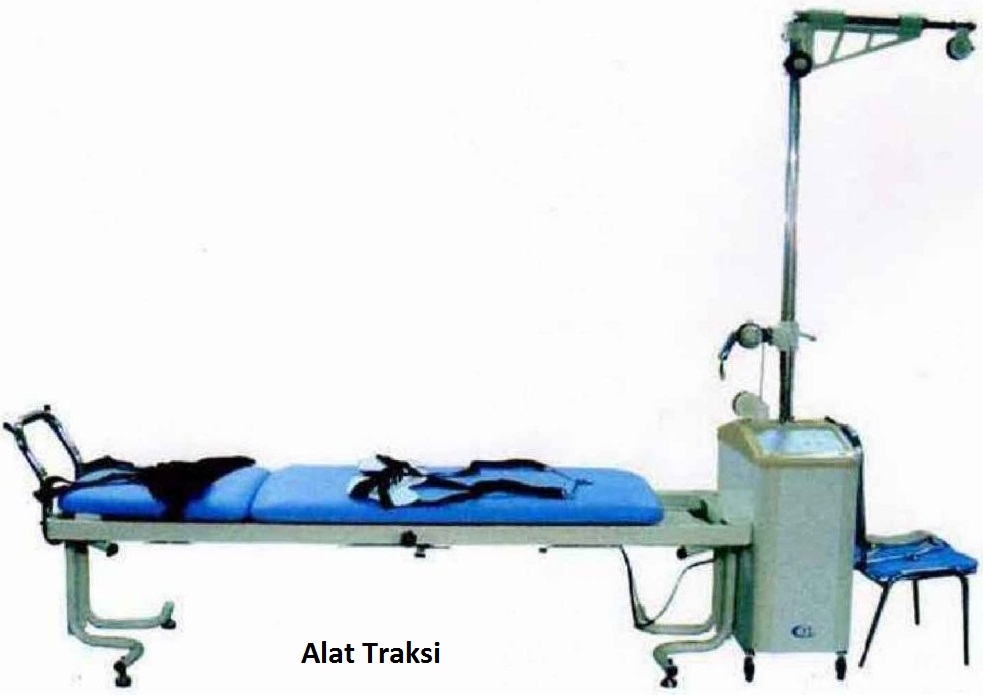 Image result for traksi fisioterapi