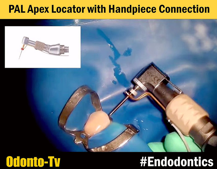 ENDODONTICS PAL Apex Locator with Handpiece Connection