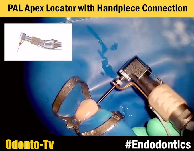 ENDODONTICS: PAL Apex Locator with Handpiece Connection