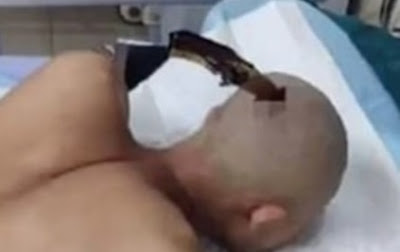 See The Moment A Man Walked Calmly To An Ambulance With A Knife Stuck To His Skull