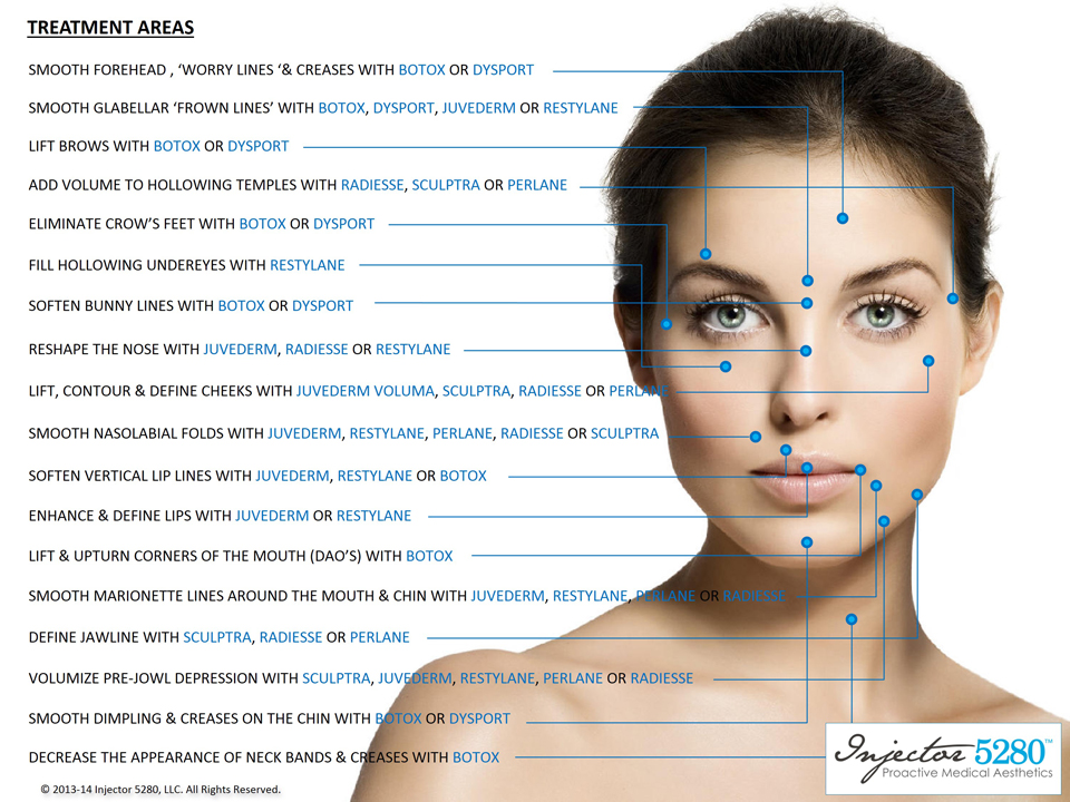 Ráncfeltöltés, szájfeltöltés, arcformázás és az erre ... eyebrow lift diagram 