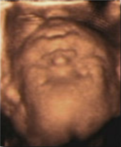 Hafta hafta bebeğin ultrason görüntüleri-22.hafta