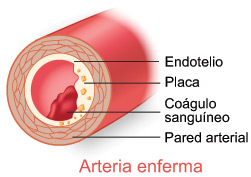 Proyecto Homo: EL ENDOTELIO VASCULAR