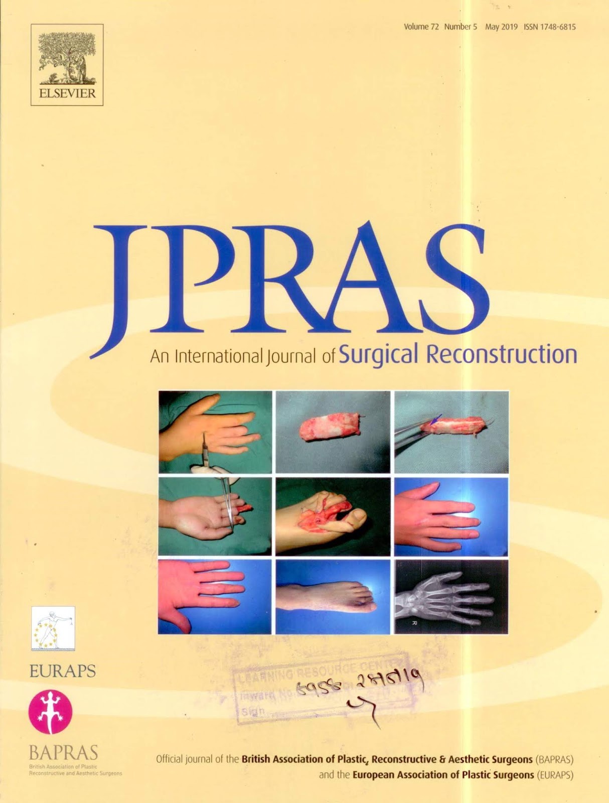 https://www.sciencedirect.com/journal/journal-of-plastic-reconstructive-and-aesthetic-surgery/vol/72/issue/5