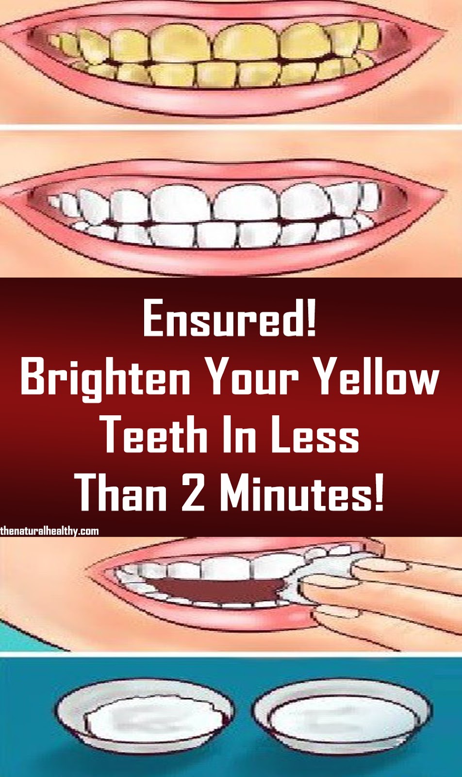 Ensured! Brighten Your Yellow Teeth In Less Than 2 Minutes