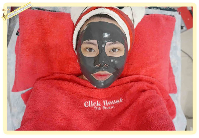 acne removal treatment click house